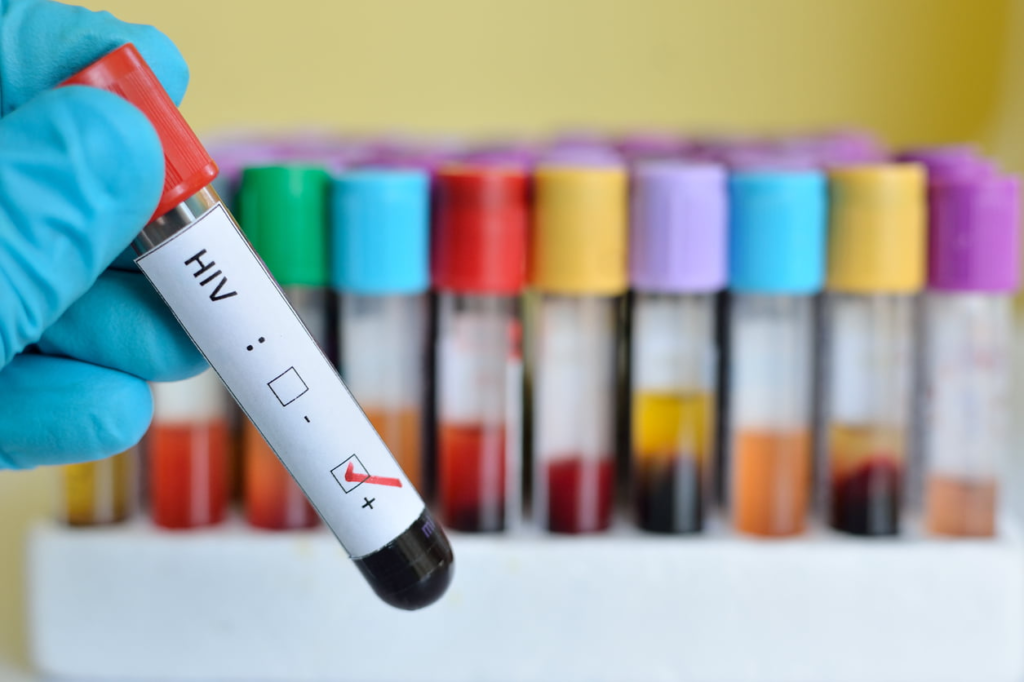 Akwa Ibom, Other Niger Delta States Amongst Top HIV Prevalence States